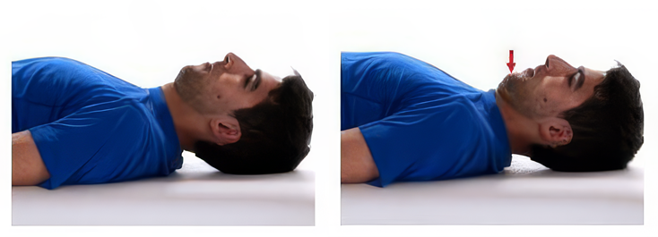 Photos of steps for head press