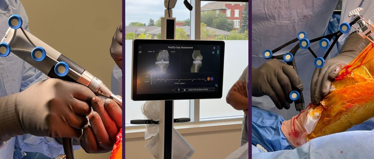 Photos of an x-ray and a physician using tools to perform orthopedic surgery